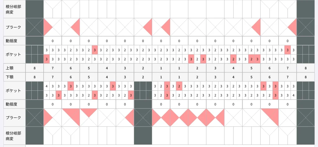 歯周ポケットの深さを記録した歯周検査表