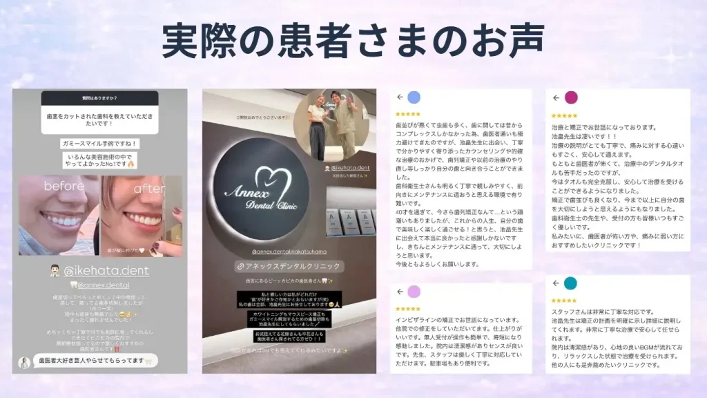 ガミースマイル治療を受けた患者さまの声