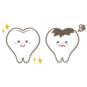 健康な歯と虫歯の画像