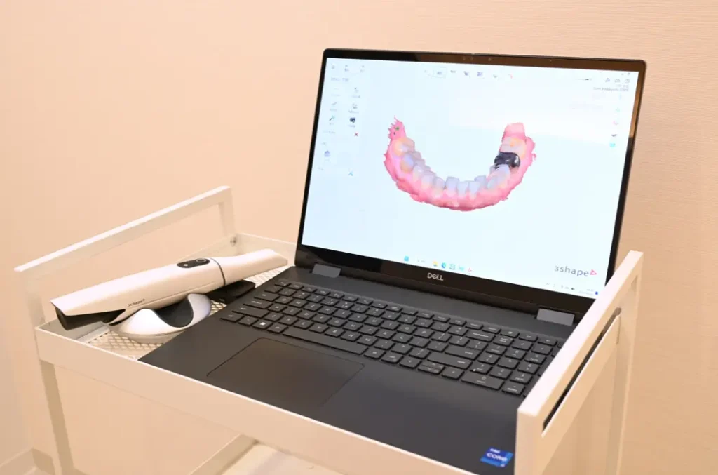 インプラントの型取りで使用する口腔内スキャナー（torios5)の写真