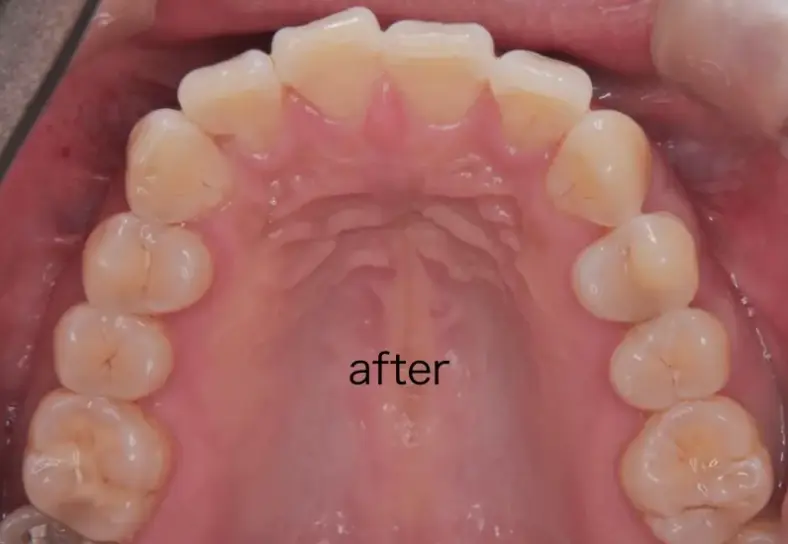 エアフローした後の写真