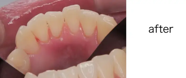 エアフローをした後の写真