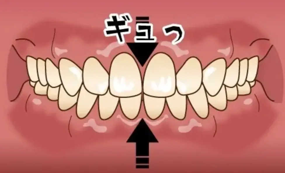 強く食いしばる、上下の歯をグッと押し付ける歯の画像